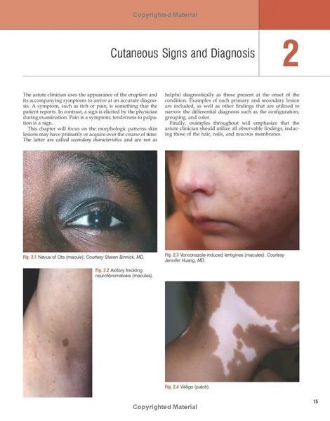 Andrews' Diseases of the Skin Clinical Atlas - Second Edition 11122 фото