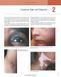 Andrews' Diseases of the Skin Clinical Atlas - Second Edition 11122 фото 3